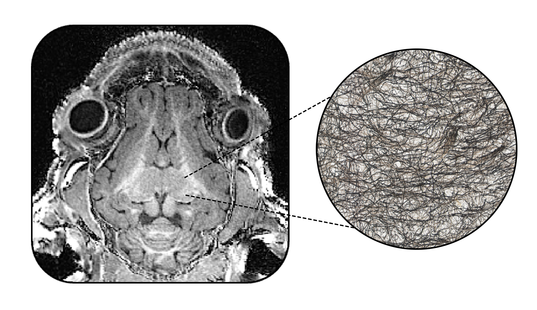 A T1-weighted MRI image of the transverse view of the pig brain next to a close-up cut-out showcases individual myelin fibers of the hippocampus.